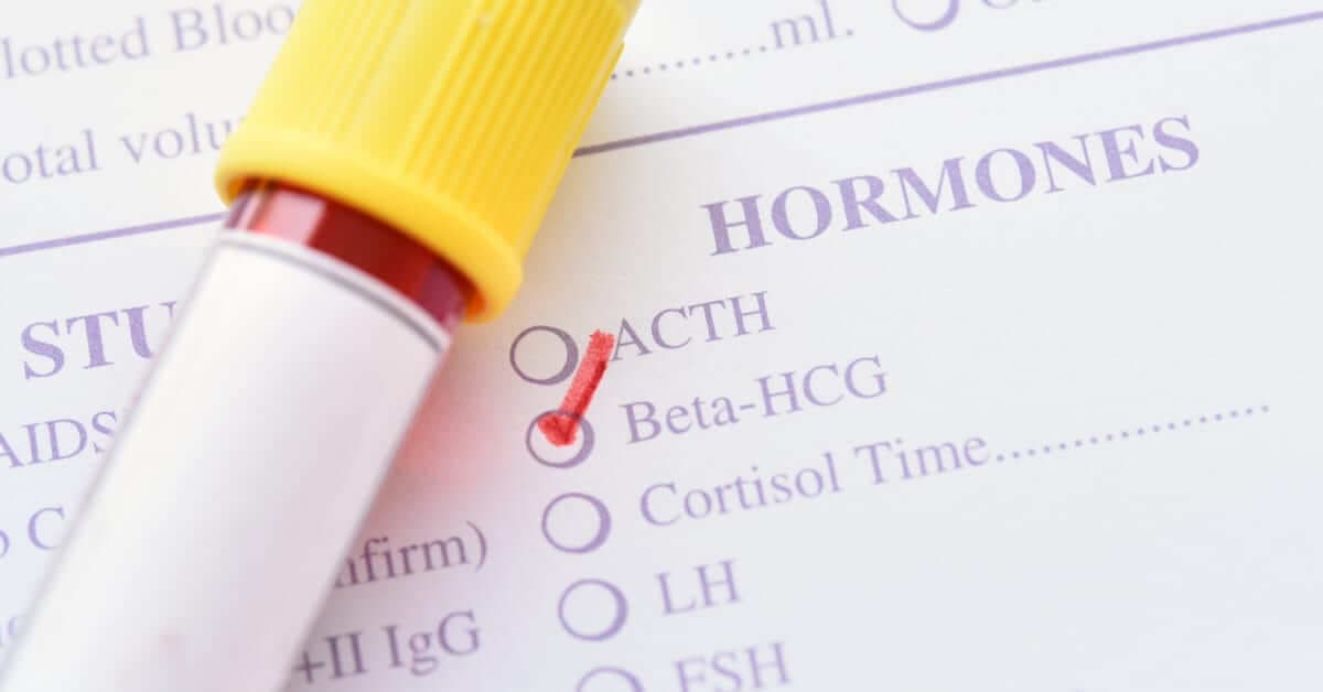 Beta HCG Nedir? Hafta Hafta Gebelikte HCG Değerleri ve Yorumları