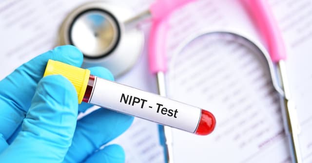 NIPT Testi Nedir? image