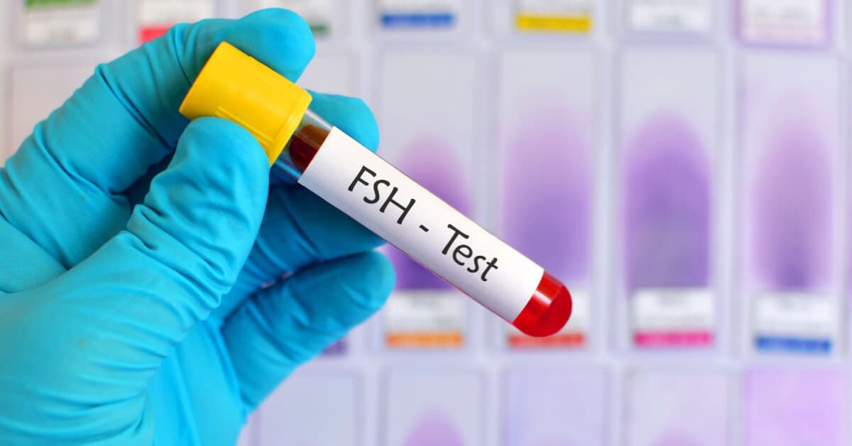 FSH Nedir? kapak resmi