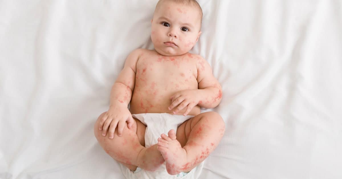 Yenidoğan Bebeklerde Görülen Hastalıklar