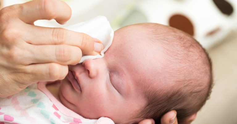 Bebeklerde Göz Hastalıkları Belirtileri ve Tedavisi