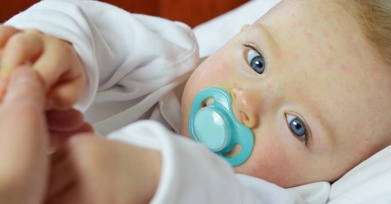 bebeklerde-altinci-hastalik-belirtileri-ve-tedavisi